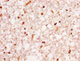 IHC image diluted at 1:300 and staining in paraffin-embedded human brain tissue performed on a Leica BondTM system. After dewaxing and hydration, antigen retrieval was mediated by high pressure in a citrate buffer (pH 6.0). Section was blocked with 10% normal goat serum 30min at RT. Then primary antibody (1% BSA) was incubated at 4°C overnight. The primary is detected by a biotinylated secondary antibody and visualized using an HRP conjugated SP system.