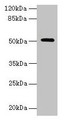 Western blot; All lanes: NR1H3 antibody at 6µg/ml + Mouse liver tissue; Secondary; Goat polyclonal to rabbit IgG at 1/10000 dilution; Predicted band size: 51, 44, 46 kDa; Observed band size: 51 kDa