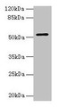 Western blot; ,All lanes: CS antibody at 3µg/ml + HepG2 whole cell lysate; ,Secondary; ,Goat polyclonal to rabbit IgG at 1/10000 dilution; ,Predicted band size: 52 kDa; ,Observed band size: 52 kDa
