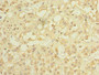 Immunohistochemistry of paraffin-embedded human adrenal gland tissue using CAC07580 at dilution of 1: 100