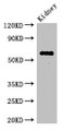 Western Blot; , Positive WB detected in: Mouse kidney tissue; , All lanes: TSBP1 Antibody at 3.4µg/ml; , Secondary; , Goat polyclonal to rabbit IgG at 1/50000 dilution; , Predicted band size: 62 kDa; , Observed band size: 62 kDa