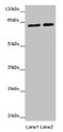 Western blot; All lanes: DHX33 antibody at 16µg/ml; Lane 1: Hela whole cell lysate; Lane 2: 293T whole cell lysate; Secondary; Goat polyclonal to rabbit IgG at 1/10000 dilution; Predicted band size: 79, 61 kDa; Observed band size: 79 kDa
