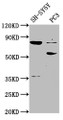 Western Blot; , Positive WB detected in: SH-SY5Y whole cell lysate, PC-3 whole cell lysate; , All lanes: ABLIM1 antibody at 1:2000; , Secondary; , Goat polyclonal to rabbit IgG at 1/50000 dilution; , Predicted band size: 88, 82, 49, 47, 53, 85 kDa; , Observed band size: 88, 53 kDa; Western Blot; , Positive WB detected in: SH-SY5Y whole cell lysate, PC-3 whole cell lysate; , All lanes: ABLIM1 antibody at 1:2000; , Secondary; , Goat polyclonal to rabbit IgG at 1/50000 dilution; , Predicted band size: 88, 82, 49, 47, 53, 85 kDa; , Observed band size: 88, 53 kDa;