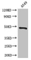 Western Blot; Positive WB detected in: A549 whole cell lysate; All lanes: EIF4A3 antibody at 3µg/ml; Secondary; Goat polyclonal to rabbit IgG at 1/50000 dilution; Predicted band size: 47 kDa; Observed band size: 47 kDa