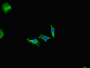 Immunofluorescent analysis of Hela cells using CAC07707 at dilution of 1:100 and Alexa Fluor 488-congugated AffiniPure Goat Anti-Rabbit IgG(H+L)