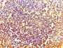 Immunohistochemistry of paraffin-embedded human tonsil tissue using CAC07710 at dilution of 1:100 Immunohistochemistry of paraffin-embedded human tonsil tissue using CAC07710 at dilution of 1:100