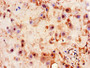 Immunohistochemistry of paraffin-embedded human placenta tissue using CAC07711 at dilution of 1:100