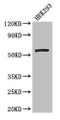 Western Blot; Positive WB detected in: HEK293 whole cell lysate; All lanes: MLYCD antibody at 2.7µg/ml; Secondary; Goat polyclonal to rabbit IgG at 1/50000 dilution; Predicted band size: 56, 51 kDa; Observed band size: 56 kDa