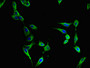 Immunofluorescent analysis of Hela cells using CAC07737 at dilution of 1:100 and Alexa Fluor 488-congugated AffiniPure Goat Anti-Rabbit IgG(H+L)
