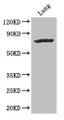 Western Blot; Positive WB detected in: Mouse lung tissue; All lanes: SLC28A3 antibody at 3µg/ml; Secondary; Goat polyclonal to rabbit IgG at 1/50000 dilution; Predicted band size: 77, 70 kDa; Observed band size: 77 kDa