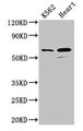Western Blot; Positive WB detected in: K562 whole cell lysate, Mouse heart tissue; All lanes: ATP5F1A antibody at 2.5µg/ml; Secondary; Goat polyclonal to rabbit IgG at 1/50000 dilution; Predicted band size: 60, 55, 58 kDa; Observed band size: 60 kDa;