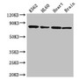 Western Blot; Positive WB detected in: K562 whole cell lysate, HL60 whole cell lysate, Mouse heart tissue, Mouse brain tissue; All lanes: BTK antibody at 3.5µg/ml; Secondary; Goat polyclonal to rabbit IgG at 1/50000 dilution; Predicted band size: 77, 80 kDa; Observed band size: 77 kDa