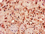 Immunohistochemistry of paraffin-embedded human placenta tissue using CAC07770 at dilution of 1:100