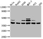 Western Blot; , Positive WB detected in: Hela whole cell lysate, HepG2 whole cell lysate, A549 whole cell lysate, MCF-7 whole cell lysate, PC-3 whole cell lysate, 293 whole cell lysate; , All lanes: MT-ND1 antibody at 1:2000; , Secondary; , Goat polyclonal to rabbit IgG at 1/50000 dilution; , Predicted band size: 36 kDa; , Observed band size: 38 kDa;
