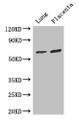 Western Blot; Positive WB detected in: Mouse lung tissue, Human placenta tissue; All lanes: STAU1 antibody at 3µg/ml; Secondary; Goat polyclonal to rabbit IgG at 1/50000 dilution; Predicted band size: 64, 55, 56 kDa; Observed band size: 64 kDa;