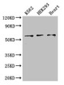 Western Blot; Positive WB detected in: K562 whole cell lysate, HEK293 whole cell lysate, Mouse heart tissue; All lanes: ZRSR2 antibody at 3µg/ml; Secondary; Goat polyclonal to rabbit IgG at 1/50000 dilution; Predicted band size: 59 kDa; Observed band size: 59 kDa;