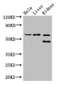 Western Blot; Positive WB detected in: Hela whole cell lysate, Mouse liver tissue, Mouse kidney tissue; All lanes: EHD2 antibody at 3µg/ml; Secondary; Goat polyclonal to rabbit IgG at 1/50000 dilution; Predicted band size: 62, 47 kDa; Observed band size: 62, 47 kDa;