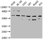 Western Blot; , Positive WB detected in: A549 whole cell lysate, HL60 whole cell lysate, U251 whole cell lysate, U87 whole cell lysate, HepG2 whole cell lysate, PC-3 whole cell lysate; , All lanes: AOAH antibody at 1:2000; , Secondary; , Goat polyclonal to rabbit IgG at 1/50000 dilution; , Predicted band size: 66, 62 kDa; , Observed band size: 66 kDa;