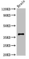 Western Blot; Positive WB detected in: Mouse brain tissue; All lanes: CASP12 antibody at 2.7µg/ml; Secondary; Goat polyclonal to rabbit IgG at 1/50000 dilution; Predicted band size: 39, 20, 30 kDa; Observed band size: 39 kDa; Western Blot; Positive WB detected in: Mouse brain tissue; All lanes: CASP12 antibody at 2.7µg/ml; Secondary; Goat polyclonal to rabbit IgG at 1/50000 dilution; Predicted band size: 39, 20, 30 kDa; Observed band size: 39 kDa;