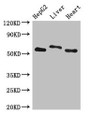Western Blot; Positive WB detected in: HepG2 whole cell lysate, Rat liver tissue, Mouse heart tissue; All lanes: SLC13A5 antibody at 2.7µg/ml; Secondary; Goat polyclonal to rabbit IgG at 1/50000 dilution; Predicted band size: 64, 59, 62 kDa; Observed band size: 64, 59 kDa;