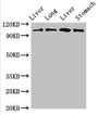 Western Blot; Positive WB detected in: Rat liver tissue, Rat lung tissue, Mouse liver tissue, Mouse stomach tissue; All lanes: MAP3K13 antibody at 3µg/ml; Secondary; Goat polyclonal to rabbit IgG at 1/50000 dilution; Predicted band size: 109, 18, 93, 86, 15 kDa; Observed band size: 109 kDa;