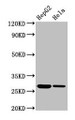 Western Blot; Positive WB detected in: HepG2 whole cell lysate, Hela whole cell lysate; All lanes: VPS29 antibody at 3.4µg/ml; Secondary; Goat polyclonal to rabbit IgG at 1/50000 dilution; Predicted band size: 21 kDa; Observed band size: 28 kDa