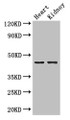 Western Blot; ,Positive WB detected in: Mouse heart tissue, Mouse kidney tissue; ,All lanes: NRXN1 antibody at 2µg/ml; ,Secondary; ,Goat polyclonal to rabbit IgG at 1/50000 dilution; ,Predicted band size: 47, 51, 162, 165, 170, 16 kDa; ,Observed band size: 47 kDa;