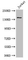 Western Blot; Positive WB detected in: Jurkat whole cell lysate; All lanes: ATXN2 antibody at 3µg/ml; Secondary; Goat polyclonal to rabbit IgG at 1/50000 dilution; Predicted band size: 141, 107, 28, 133, 110 kDa; Observed band size: 141 kDa