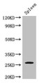 Western Blot; Positive WB detected in: Mouse spleen tissue; All lanes: ZC4H2 antibody at 3µg/ml; Secondary; Goat polyclonal to rabbit IgG at 1/50000 dilution; Predicted band size: 27, 16, 24, 21, 26 kDa; Observed band size: 27 kDa;