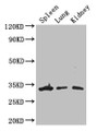 Western Blot; Positive WB detected in: Mouse spleen tissue, Mouse lung tissue, Mouse kidney tissue; All lanes: ALKBH4 antibody at 3µg/ml; Secondary; Goat polyclonal to rabbit IgG at 1/50000 dilution; Predicted band size: 34, 5 kDa; Observed band size: 34 kDa;