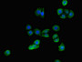 Immunofluorescent analysis of PC-3 cells using CAC08120 at dilution of 1:100 and Alexa Fluor 488-congugated AffiniPure Goat Anti-Rabbit IgG(H+L)