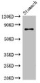 Western Blot; Positive WB detected in: Mouse stomach tissue; All lanes: SCIN antibody at 3.5µg/ml; Secondary; Goat polyclonal to rabbit IgG at 1/50000 dilution; Predicted band size: 81, 66, 53 kDa; Observed band size: 81 kDa
