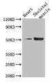 Western Blot; Positive WB detected in: Mouse heart tissue, Mouse skeletal muscle tissue; All lanes: TPH1 antibody at 2.5µg/ml; Secondary; Goat polyclonal to rabbit IgG at 1/50000 dilution; Predicted band size: 51, 54 kDa; Observed band size: 51 kDa Western Blot; Positive WB detected in: Mouse heart tissue, Mouse skeletal muscle tissue; All lanes: TPH1 antibody at 2.5µg/ml; Secondary; Goat polyclonal to rabbit IgG at 1/50000 dilution; Predicted band size: 51, 54 kDa; Observed band size: 51 kDa