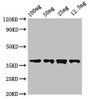Western Blot; ,Positive WB detected in Recombinant protein; ,All lanes: DST antibody at 3.5µg/ml; ,Secondary; ,Goat polyclonal to rabbit IgG at 1/50000 dilution; ,Predicted band size: 37 kDa; ,Observed band size: 37 kDa