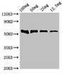 Western Blot; ,Positive WB detected in Recombinant protein; ,All lanes: DNAH12 antibody at 4µg/ml; ,Secondary; ,Goat polyclonal to rabbit IgG at 1/50000 dilution; ,Predicted band size: 53 kDa; ,Observed band size: 53 kDa Western Blot; ,Positive WB detected in Recombinant protein; ,All lanes: DNAH12 antibody at 4µg/ml; ,Secondary; ,Goat polyclonal to rabbit IgG at 1/50000 dilution; ,Predicted band size: 53 kDa; ,Observed band size: 53 kDa