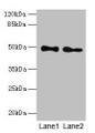Western blot; All lanes: ABHD2 antibody at 10µg/ml; Lane 1: Mouse heart tissue; Lane 2: Rat gonadal tissue; Secondary; Goat polyclonal to rabbit IgG at 1/10000 dilution; Predicted band size: 49 kDa; Observed band size: 49 kDa Western blot; All lanes: ABHD2 antibody at 10µg/ml; Lane 1: Mouse heart tissue; Lane 2: Rat gonadal tissue; Secondary; Goat polyclonal to rabbit IgG at 1/10000 dilution; Predicted band size: 49 kDa; Observed band size: 49 kDa