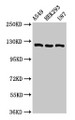 Western Blot; , Positive WB detected in: A549 whole cell lysate, HEK293 whole cell lysate, U87 whole cell lysate; , All lanes: ACLY antibody at 8µg/ml; , Secondary; , Goat polyclonal to rabbit IgG at 1/50000 dilution; , Predicted band size: 121, 120, 92 kDa; , Observed band size: 121 kDa