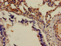 Immunohistochemistry of paraffin-embedded human lung tissue using CAC08214 at dilution of 1:100
