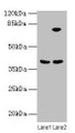 Western blot; ,All lanes: ANXA9 antibody at 8µg/ml; ,Lane 1: Mouse kidney tissue; ,Lane 2: A431 whole cell lysate; ,Secondary; ,Goat polyclonal to rabbit IgG at 1/10000 dilution; ,Predicted band size: 39 kDa; ,Observed band size: 39 kDa