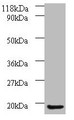 Western blot; All lanes: AP1S3 antibody at 2µg/ml + A549 whole cell lysate; Secondary; Goat polyclonal to rabbit IgG at 1/10000 dilution; Predicted band size: 19, 20, 13 kDa; Observed band size: 19 kDa
