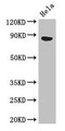 Western Blot; , Positive WB detected in: Hela whole cell lysate; , All lanes: APEH antibody at 3µg/ml; , Secondary; , Goat polyclonal to rabbit IgG at 1/50000 dilution; , Predicted band size: 82 kDa; , Observed band size: 82 kDa