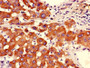 Immunohistochemistry of paraffin-embedded human liver tissue using CAC08248 at dilution of 1:100 Immunohistochemistry of paraffin-embedded human liver tissue using CAC08248 at dilution of 1:100