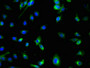 Immunofluorescent analysis of U251 cells using CAC08251 at dilution of 1:100 and Alexa Fluor 488-congugated AffiniPure Goat Anti-Rabbit IgG(H+L)