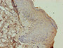 Immunohistochemistry of paraffin-embedded human skin tissue using CAC08252 at dilution of 1:100