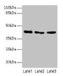 Western blot; All lanes: ATXN3 antibody at 2µg/ml; Lane 1: 293T whole cell lysate; Lane 2: Mouse brain tissue; Lane 3: MCF-7 whole cell lysate; Secondary; Goat polyclonal to rabbit IgG at 1/10000 dilution; Predicted band size: 42, 36, 40, 21 kDa; Observed band size: 42 kDa