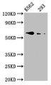 Western Blot; ,Positive WB detected in: K562 whole cell lysate, 293 whole cell lysate; ,All lanes: BMPR1A antibody at 3.3µg/ml; ,Secondary; ,Goat polyclonal to rabbit IgG at 1/50000 dilution; ,Predicted band size: 61 kDa; ,Observed band size: 61 kDa