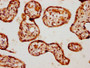 IHC image diluted at 1:1000 and staining in paraffin-embedded human placenta tissue performed on a Leica BondTM system. After dewaxing and hydration, antigen retrieval was mediated by high pressure in a citrate buffer (pH 6.0). Section was blocked with 10% normal goat serum 30min at RT. Then primary antibody (1% BSA) was incubated at 4°C overnight. The primary is detected by a biotinylated secondary antibody and visualized using an HRP conjugated SP system.