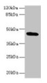 Western blot; All lanes: C19orf47 antibody at 10µg/ml + Mouse muscle tissue; Secondary; Goat polyclonal to rabbit IgG at 1/10000 dilution; Predicted band size: 45, 38, 30 kDa; Observed band size: 45 kDa