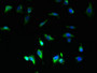 Immunofluorescent analysis of U251 cells using CAC08274 at dilution of 1:100 and Alexa Fluor 488-congugated AffiniPure Goat Anti-Rabbit IgG(H+L)
