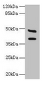 Western blot; All lanes: CA12 antibody at 6µg/ml + Mouse kidney tissue; Secondary; Goat polyclonal to rabbit IgG at 1/10000 dilution; Predicted band size: 40, 39 kDa; Observed band size: 40, 48 kDa